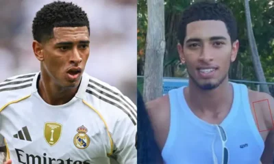 Bellingham Displays Shoulder Surgery Scar