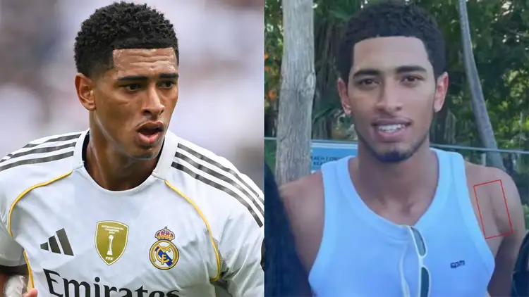 Bellingham Displays Shoulder Surgery Scar